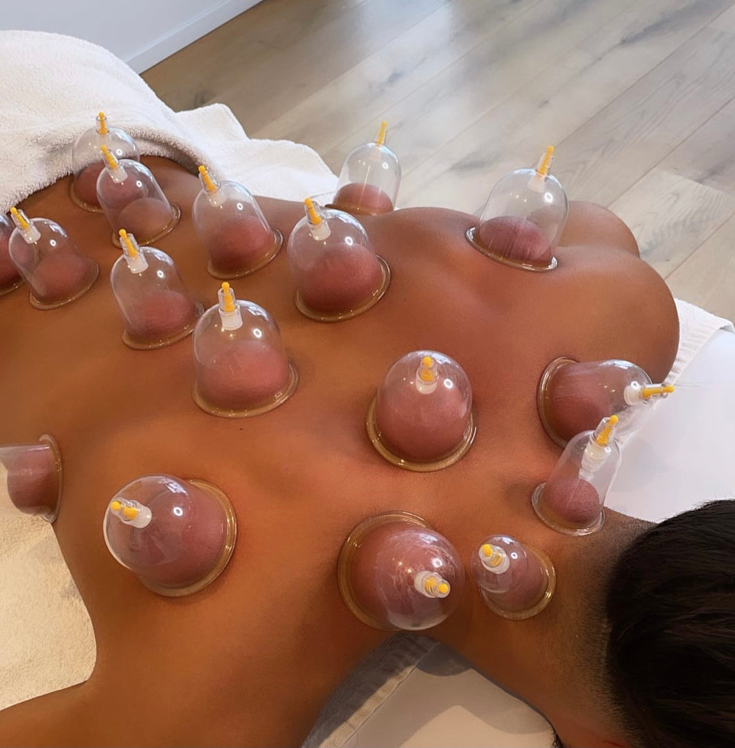 Cupping / Hijama